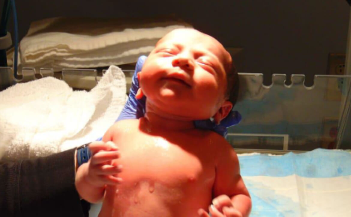 Newborn surgery